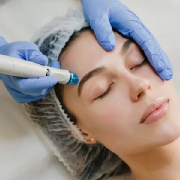 hydra facial