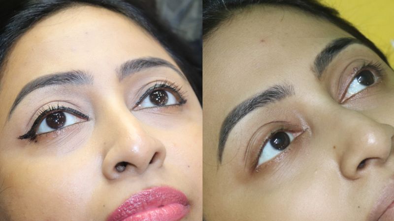 final healed result'