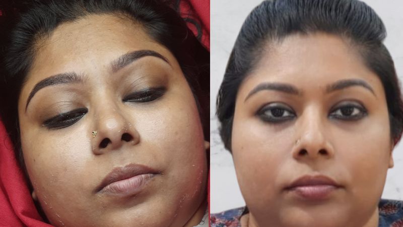 intermediate (1st sitting)