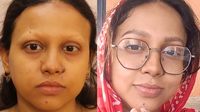 BEFORE - AFTER
