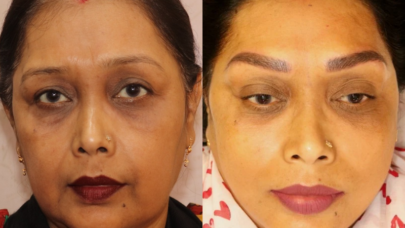 Before After (sitting 2)