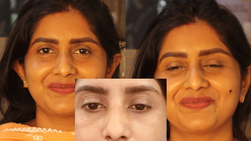 STAGE 2